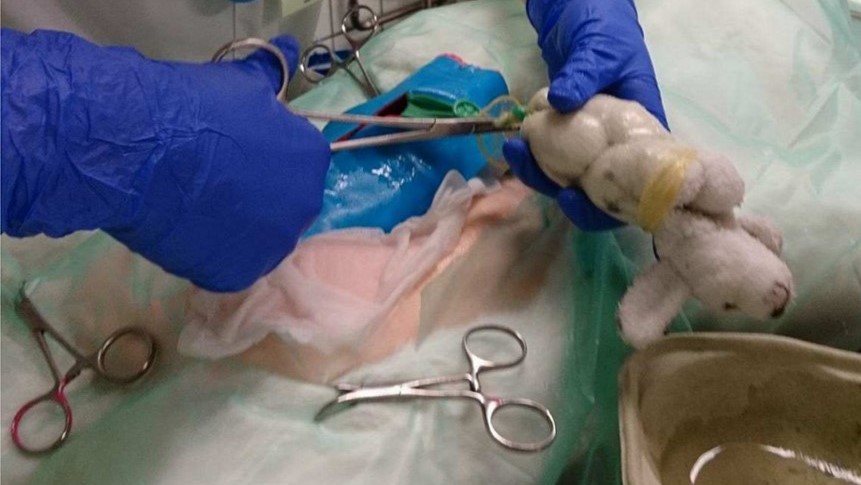 Kejsersnit3 Operation på tøjbamser